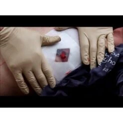 Prometheus Russell Chest Seal For Open Pneumothorax 5 Prometheus Russell Chest Seal For Open Pneumothorax -Sports Therapy Store RUS001E 2