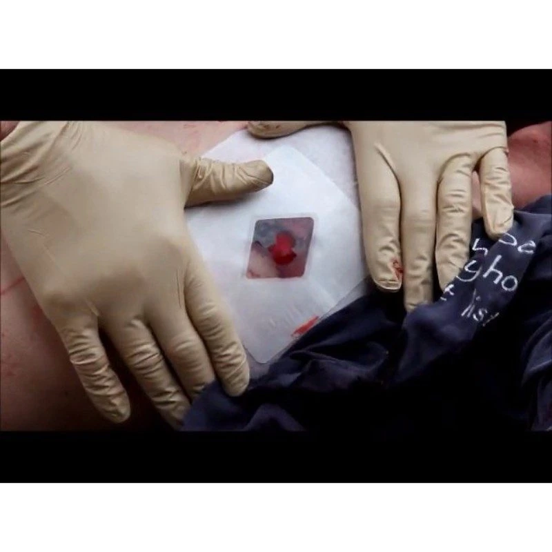 Prometheus Russell Chest Seal For Open Pneumothorax 3 Prometheus Russell Chest Seal For Open Pneumothorax - Image 3